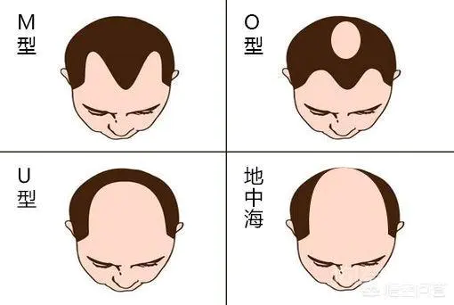 后枕部头发、毛囊为何坚固无比很难脱落?-图片1