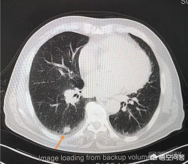 吸烟有害健康为什么还要吸烟?如何戒掉?