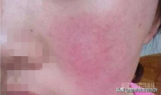 超声刀美容失败怎么办?-图片2