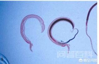 人体的寄生虫是从哪里来的?-图片1