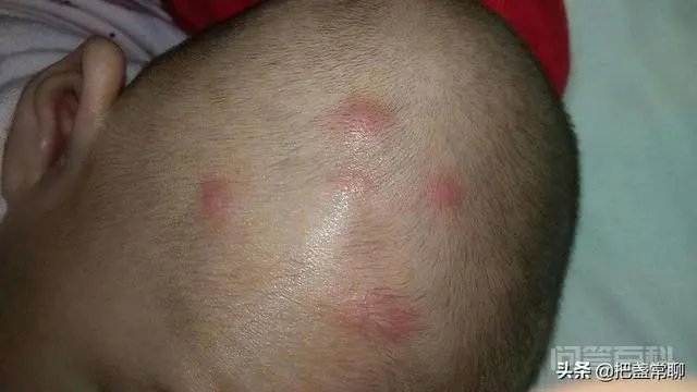 和尚,道士,儒生,三个人静坐时,有蚊子咬他们,分别有什么反应?-图片1