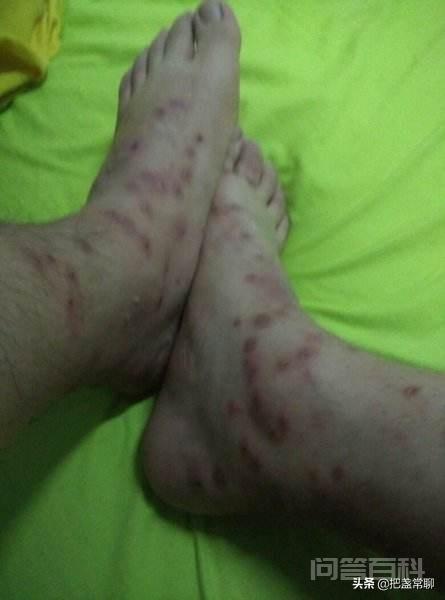 和尚,道士,儒生,三个人静坐时,有蚊子咬他们,分别有什么反应?-图片3