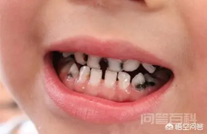 喜欢吃甜食不好吗?-图片3