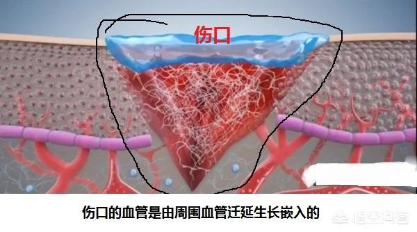 手截肢了,血管也断了,最后愈合血管能形成回流吗?-图片1