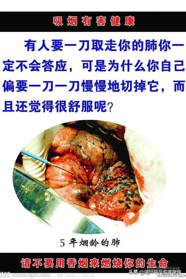 一天一包烟,有时候两包,算是抽烟频繁吗?怎么才能戒烟?-图片3