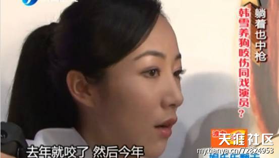 躺着也中枪 韩雪养狗咬伤同戏演员-图片1