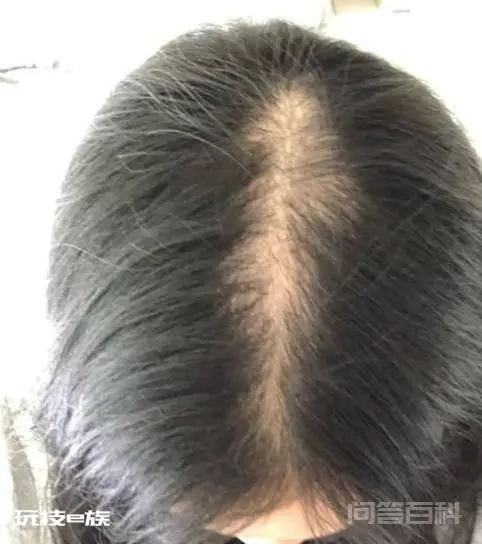 速来围观!传说中的侧柏叶洗头正能生发吗?本人亲测,效果竟……-图片2