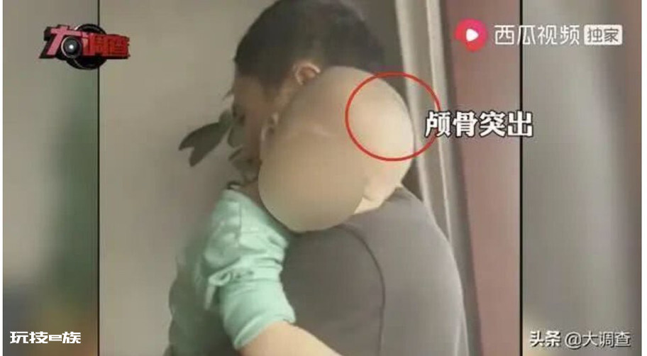永兴县市监局:暂未发现医生参与大头娃娃假奶粉事件-图片1