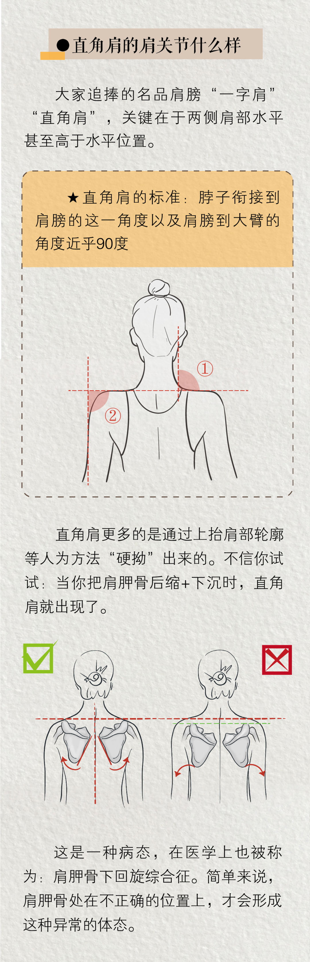 直角肩到底有多“反人类”？骨科医生说出了大实话……-图片1