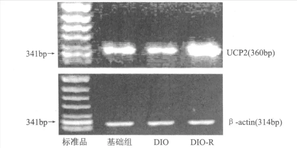重大发现：解偶联蛋白，可以加速脂肪燃烧、快速燃脂-图片17