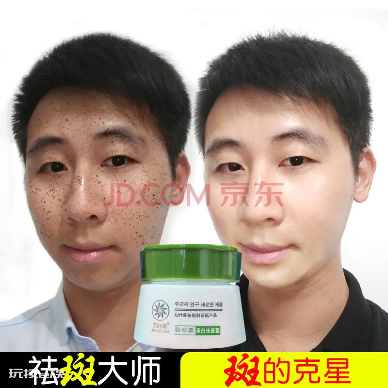 2022淡斑精油排行榜10强,想淡化色斑就选这些产品!-图片3