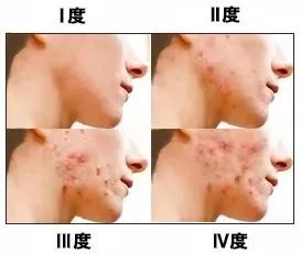从头到脚9个问题,你中招了没?华西医生送上居家生活最全健康指南!-图片5