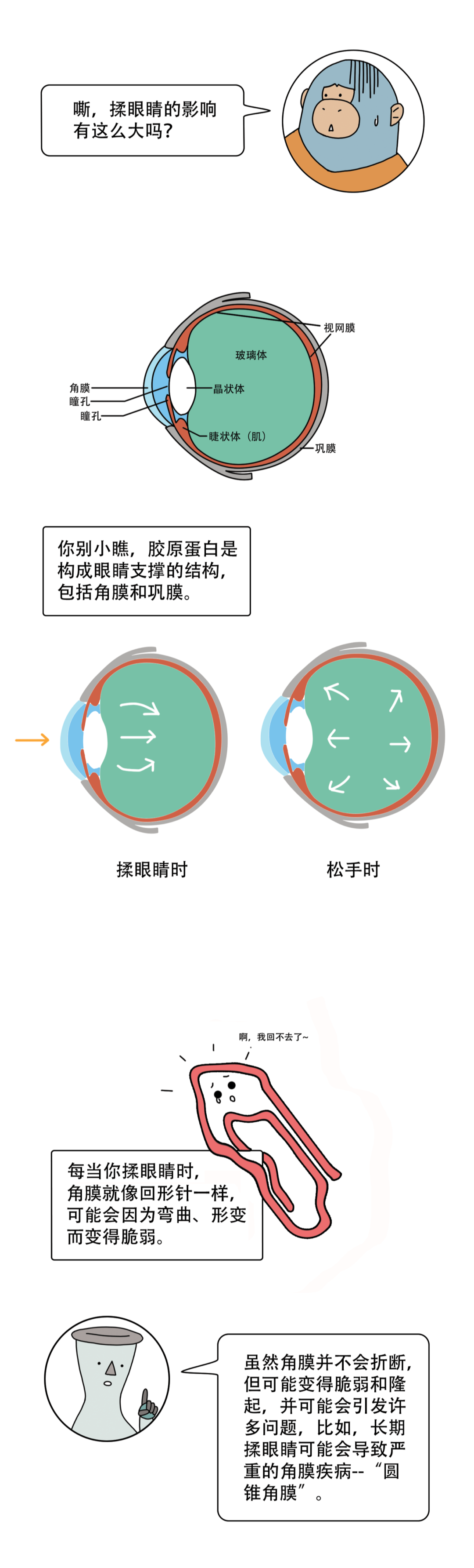 健康科普 | 揉眼睛的危害竟然这么大？！快住手！-图片4