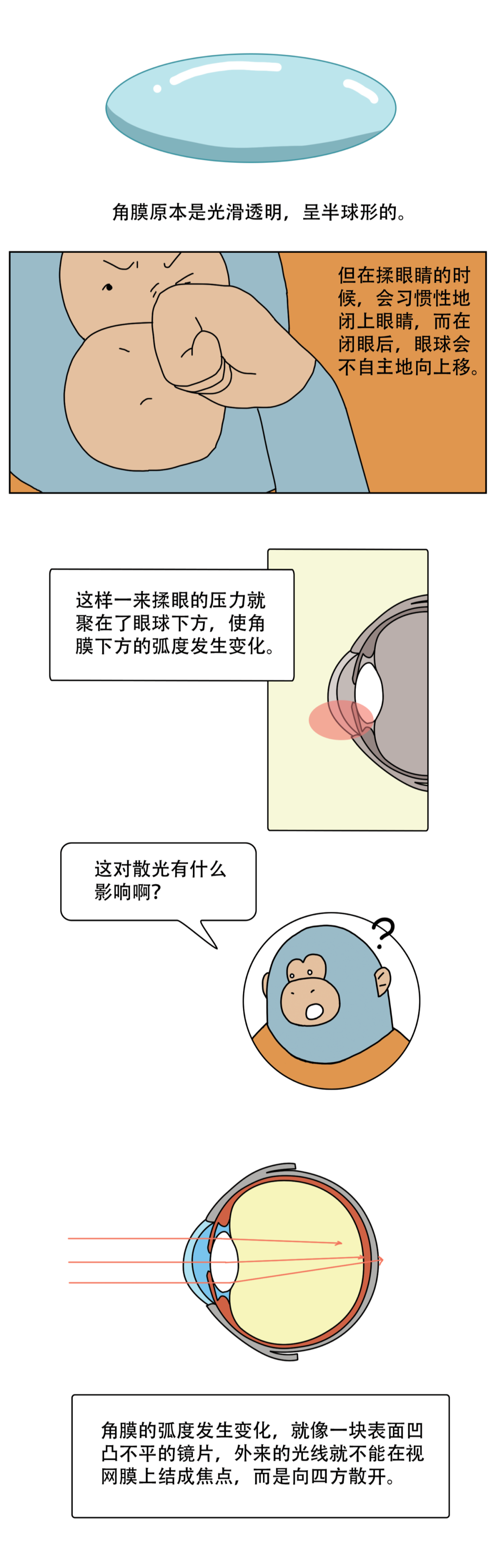 健康科普 | 揉眼睛的危害竟然这么大？！快住手！-图片7
