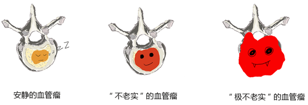 椎体血管瘤是什么意思?-图片3