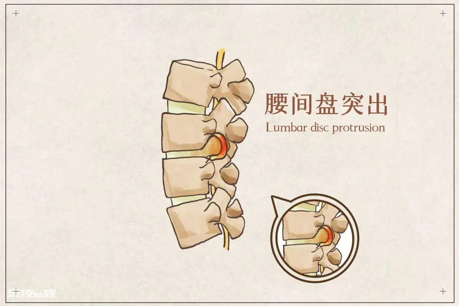 久坐不动,腰酸腰痛?一个动作帮到你!-图片2