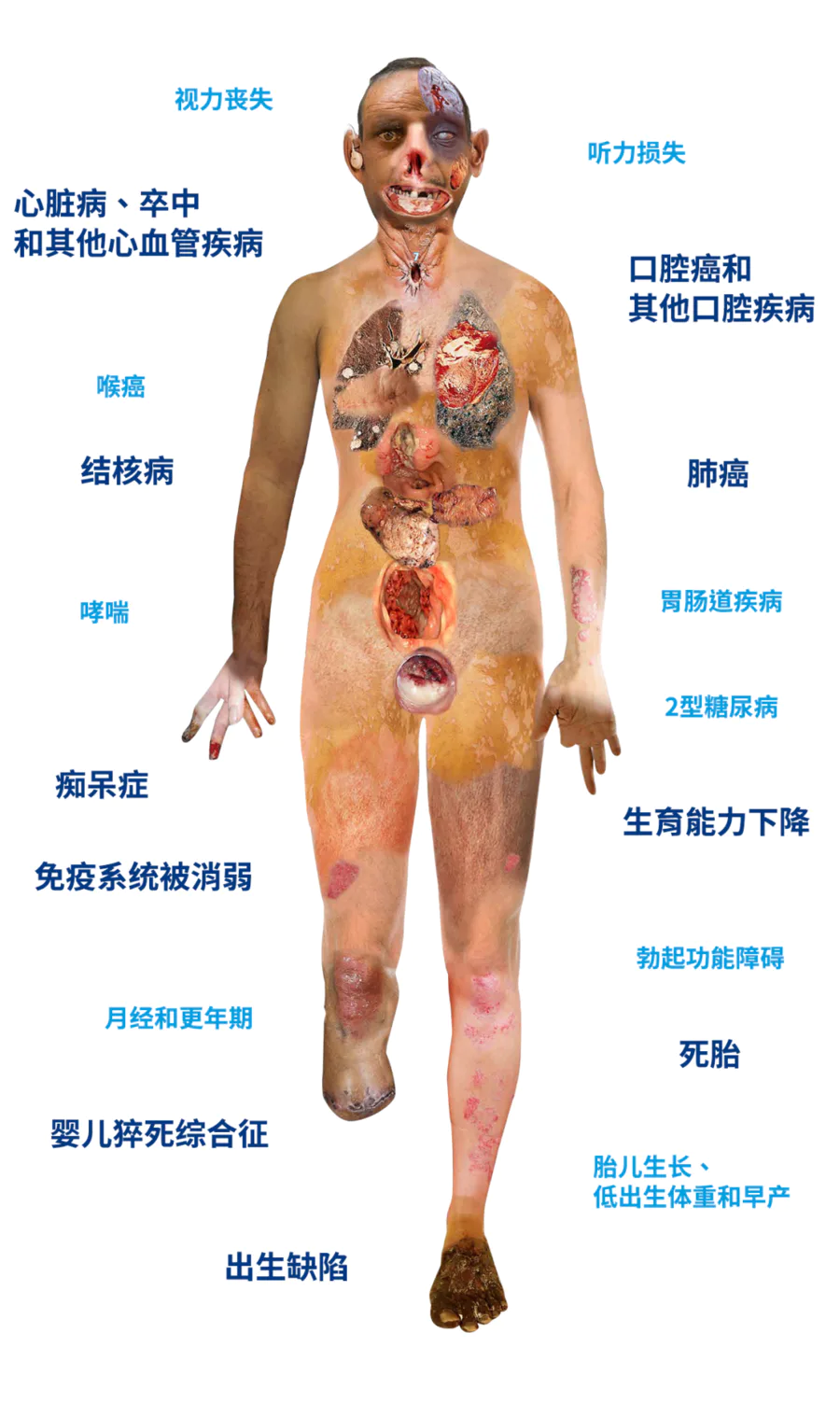 超100万中国人因它丧命!华西专家教你科学远离-图片8