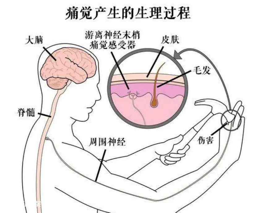 哎呦!我好痛!疼痛是如何测量的?-图片2