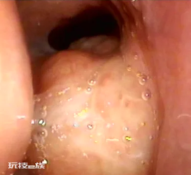 孩子打呼噜怎么办?-图片2