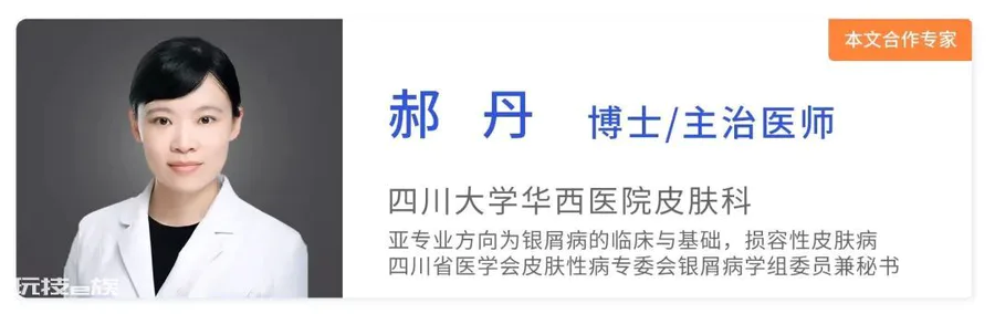 头上起皮、掉壳壳,以为是头皮屑?华西医生喊你当心这种冬季高发皮肤病!-图片1