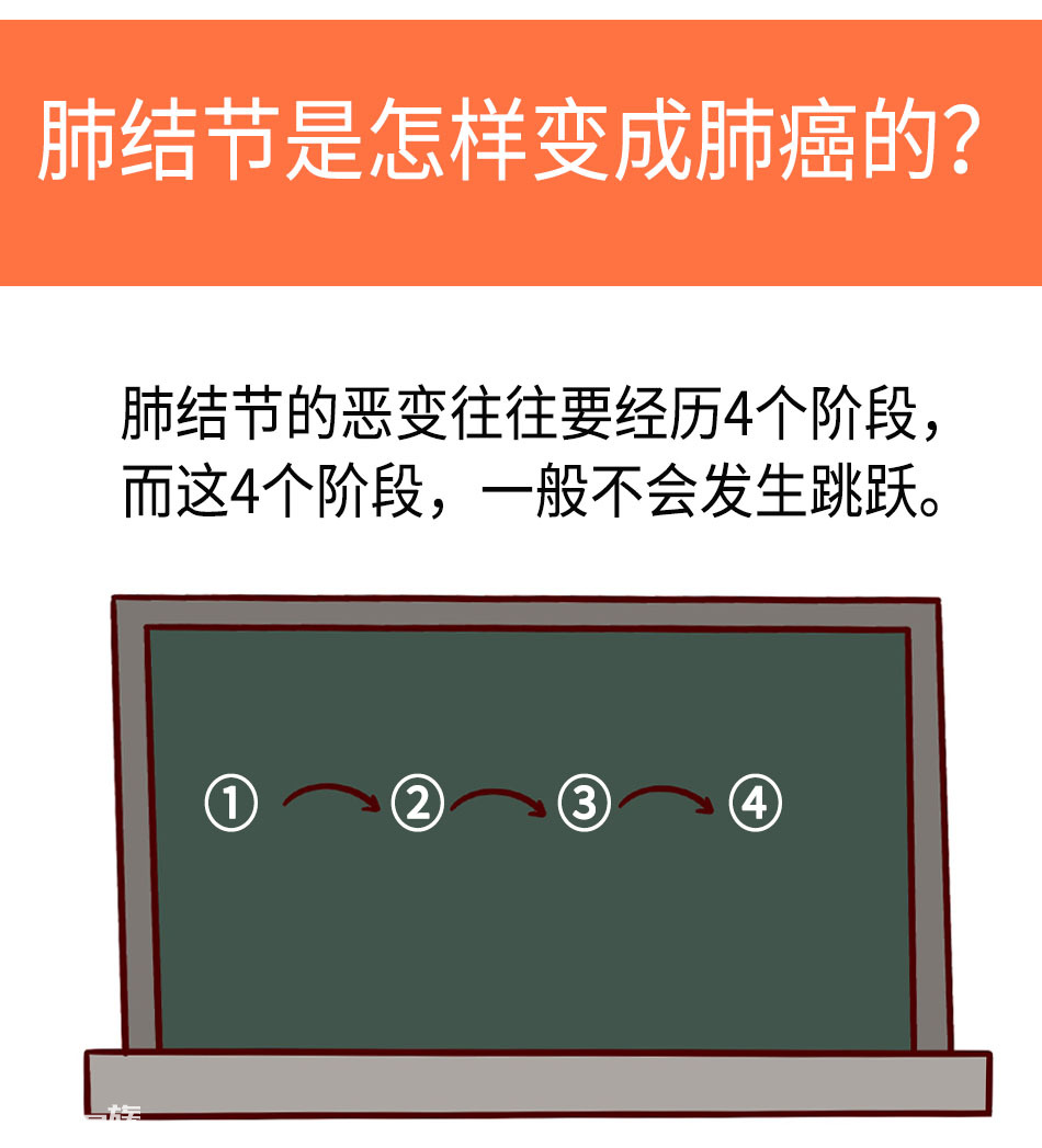 肺结节发展到肺癌，需要经历哪些阶段？
