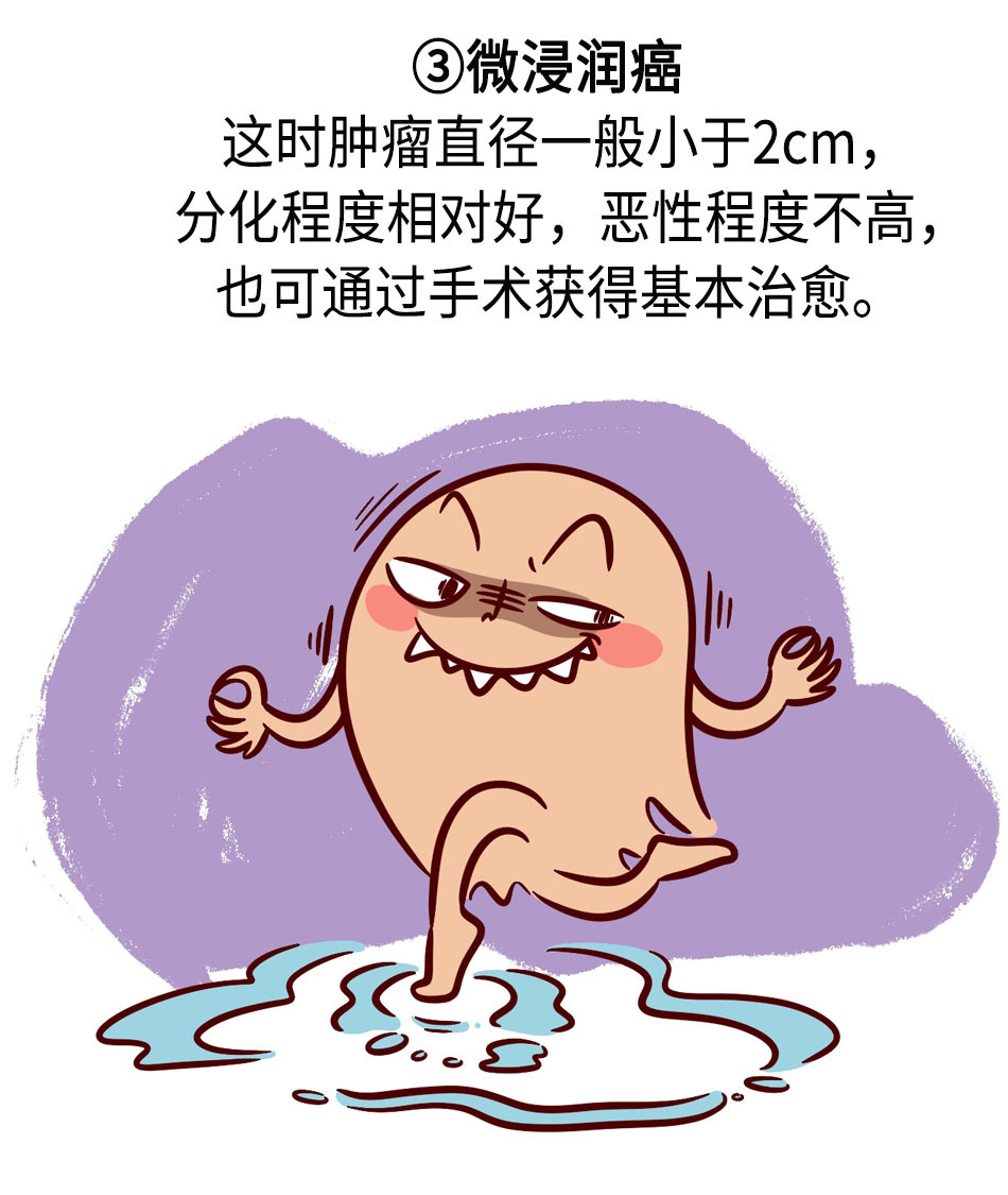 肺结节发展到肺癌，需要经历哪些阶段？