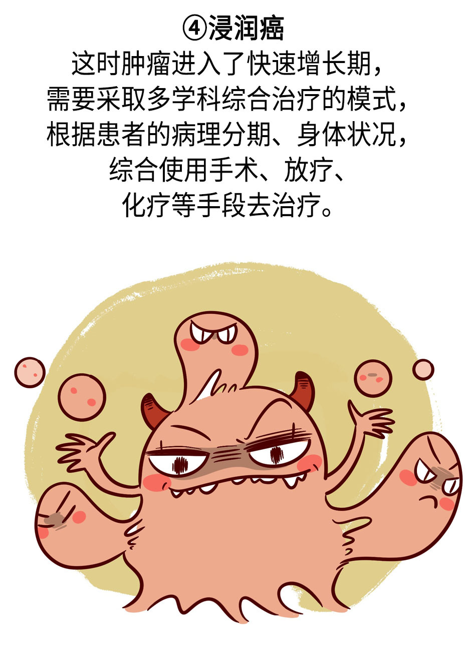 肺结节发展到肺癌，需要经历哪些阶段？